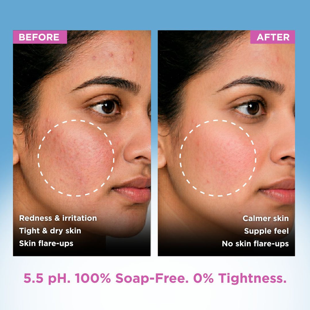 [Combo Pack] Detan Soap + Sensitive Skin Syndet Bar - Pack of 4 + 4