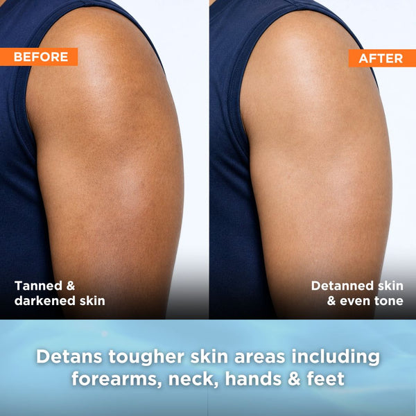 [Combo Pack] Muscle Relief Soap + Detan Soap - Pack of 4 + 4