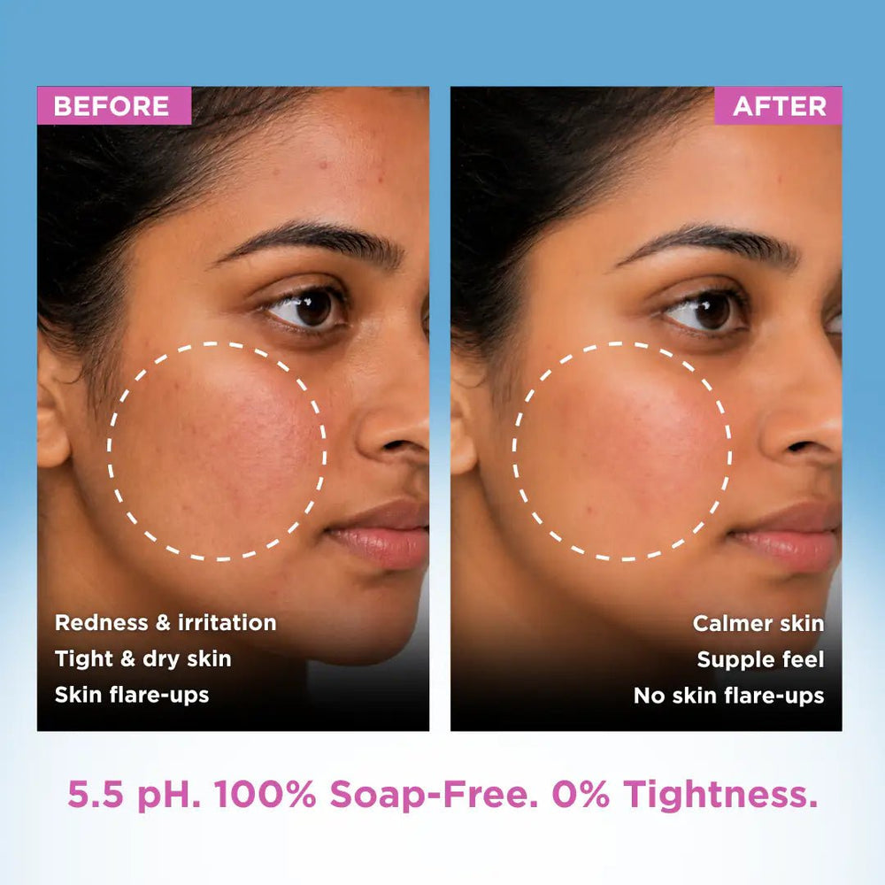 Sensitive Skin Syndet Bar - Pack of 8