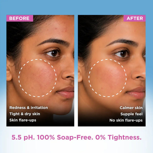 Sensitive Skin Syndet Bar - Pack of 8