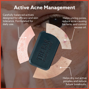 Anti Acne Soap - Pack of 4