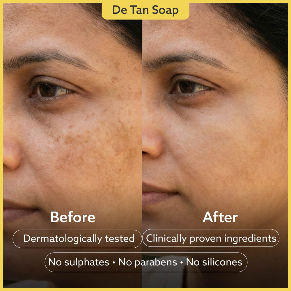 [Combo Pack] Detan Soap + Anti Acne Soap - Pack of 4 + 4