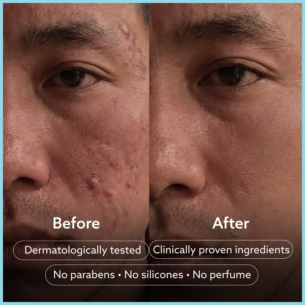 Sensitive Skin Sydnet Bar - Pack of 8